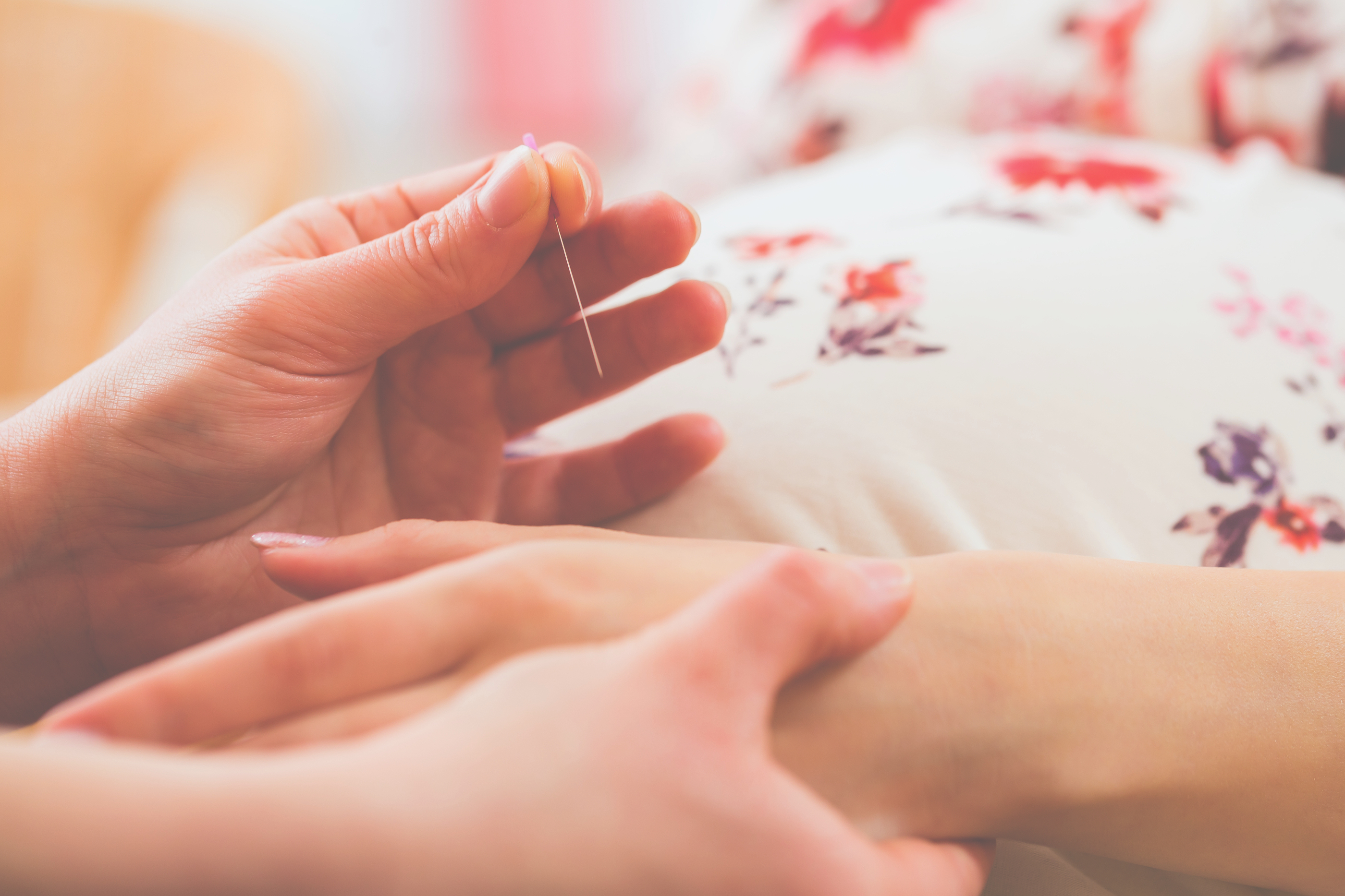 Acupuncture for Chronic Pain